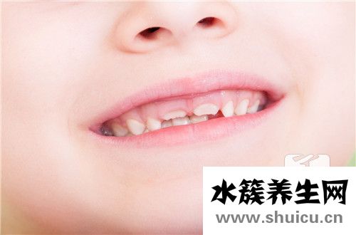 小孩牙齒發(fā)黑怎么辦