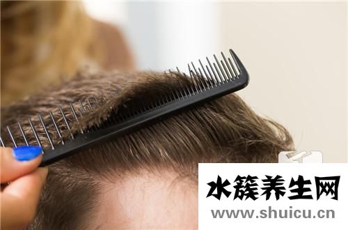 發(fā)際線高好不好