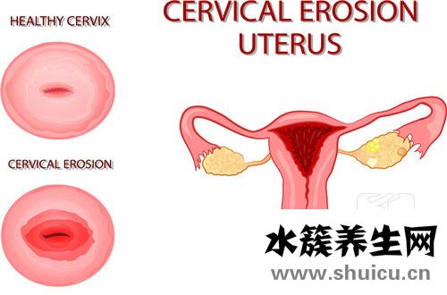 子宮內膜脫落是好是壞