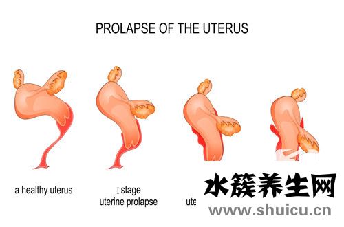 女性人乳瘤病毒照片