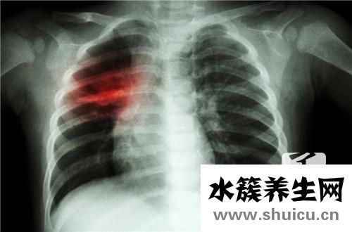 后背心疼痛是什么原因