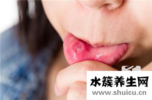 身上起水泡是什么病