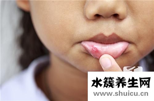 身上起水泡是什么病