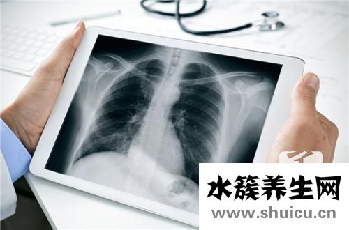 左胸間歇似針扎一樣痛