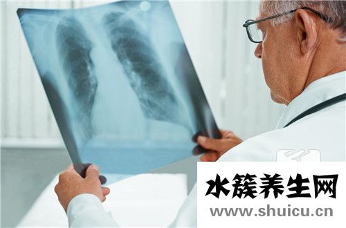 肺結(jié)核病人能活多久