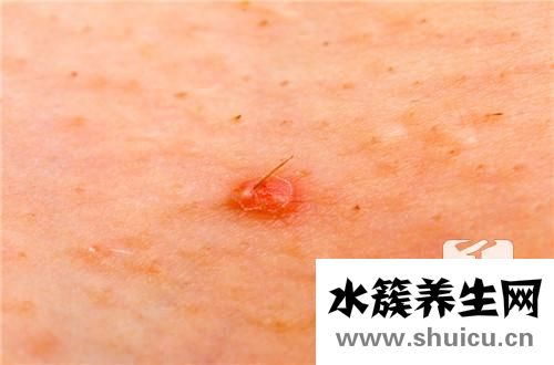 下巴長硬包按下去很痛