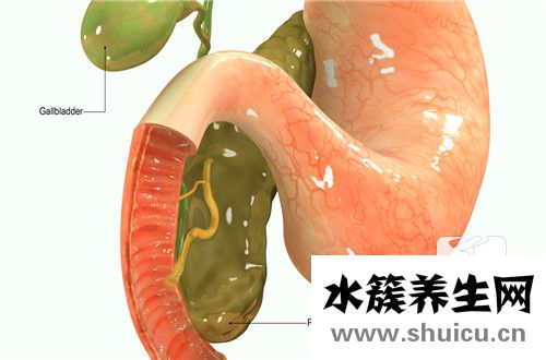 體外碎石后注意事項
