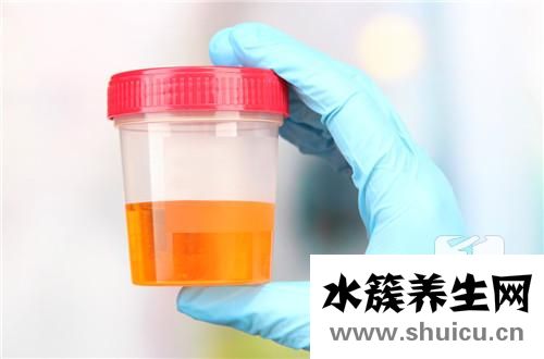 尿完有白色液體