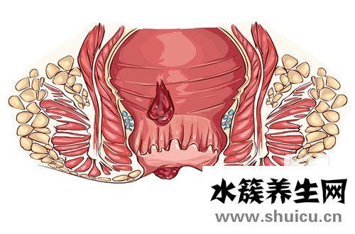 肛門整天墜漲有便意感