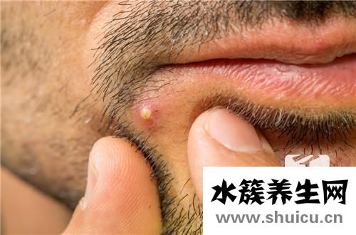 身上出硬疙瘩還癢同