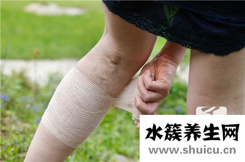 靜脈曲張按摩有效