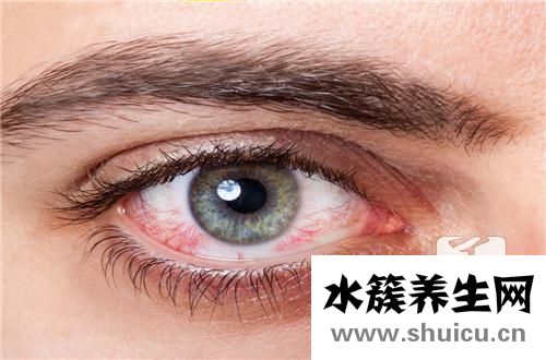 去紅血絲最有效