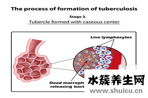 胸口感覺有東西噎著