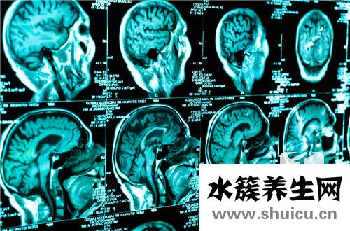 膠質瘤最后死亡