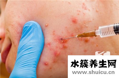 下巴起疙瘩回事