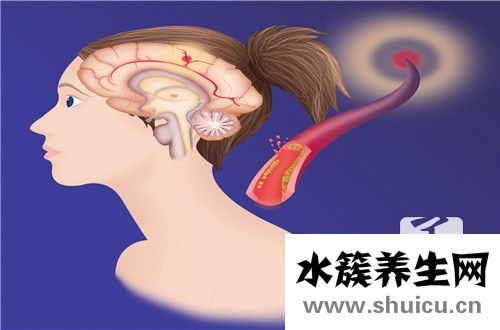 腦膜瘤手術后遺癥