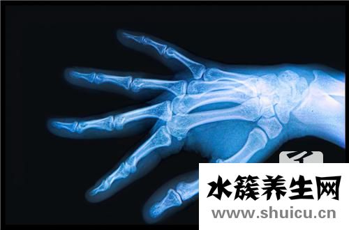 骨髓水腫是回事