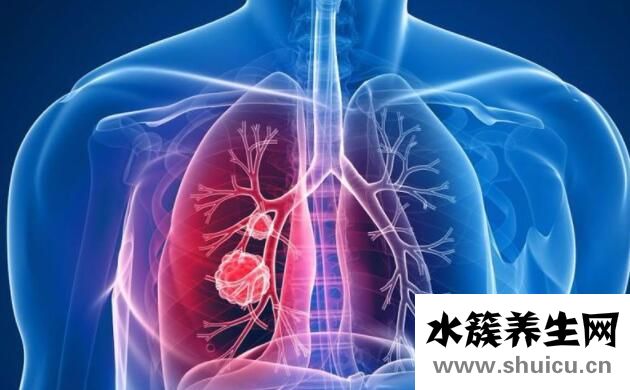 肺癌的15個征兆