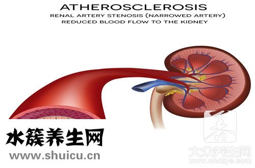 肝動脈化療栓塞術
