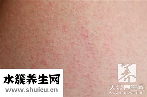 過敏能喝牛奶嗎