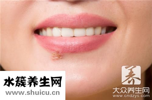 嘴唇起皰疹