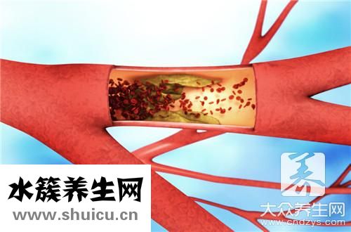 毛細血管搏動征