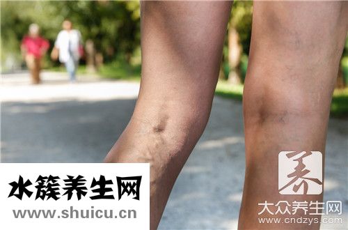 活動(dòng)性出血