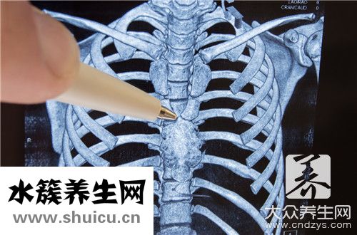 膠質(zhì)瘤能治好嗎