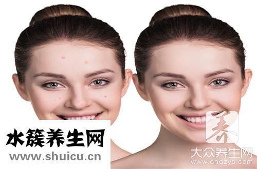 毛囊炎用什么藥膏