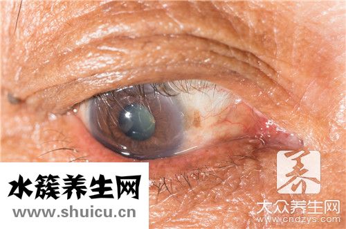 眼瞼上長小水泡