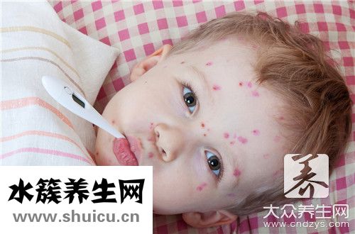 水痘潛伏期會傳染嗎