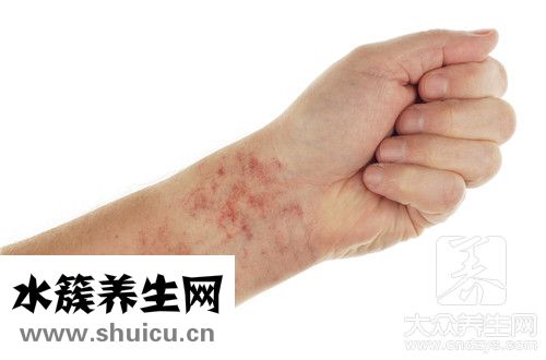 紫癜是什么引起