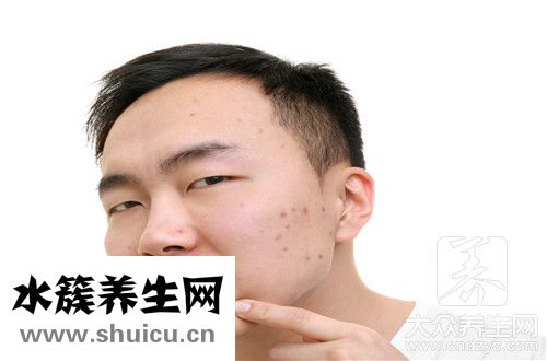 暗瘡能快速去除