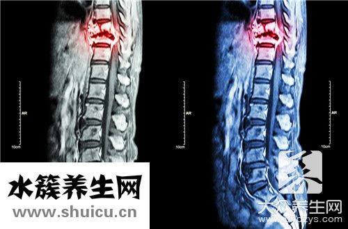 后背脊柱中間疼痛是什么原因