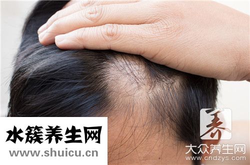 每天脫發(fā)多少算正常