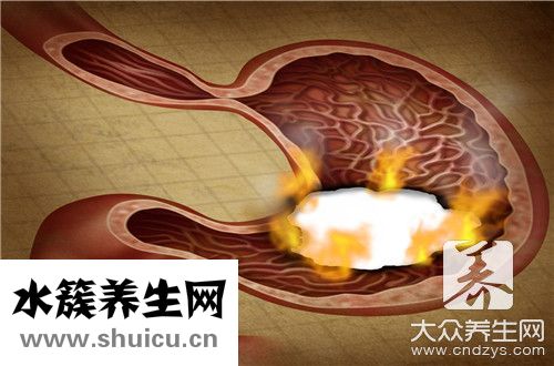 看胃病一定要胃鏡嗎