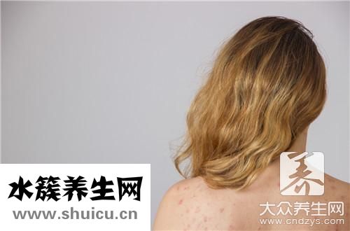 雀斑是什么原因引起