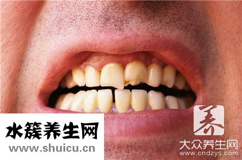 牙齒內(nèi)側(cè)有黃垢刮不掉