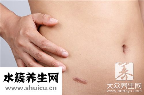 腹溝疝手術(shù)后幾天能走