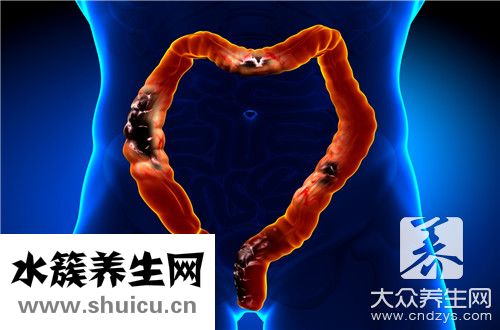 導(dǎo)管內(nèi)癌