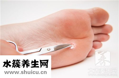 尖銳疣會自己消失