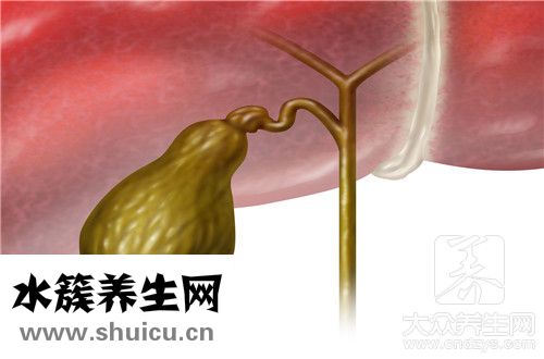 膽結(jié)石微創(chuàng)手術(shù)