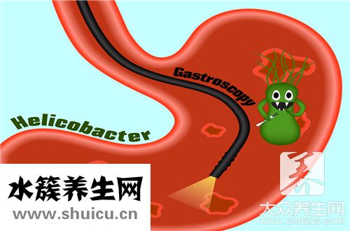 袖狀胃手術(shù)