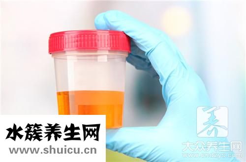 泡沫尿多久消失算正常