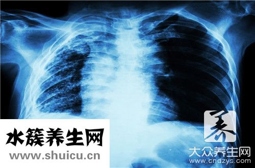 肺積水一般能活多少年