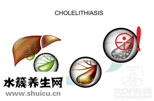 直接膽紅素偏低