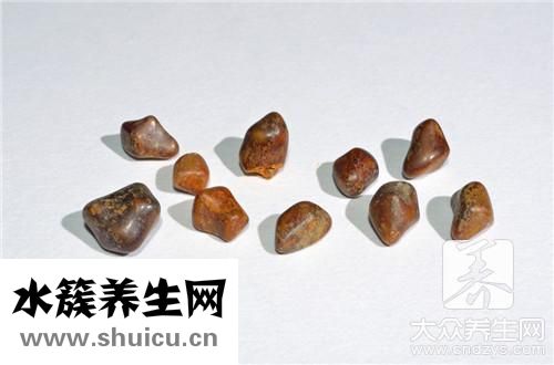 金錢草治膽結石