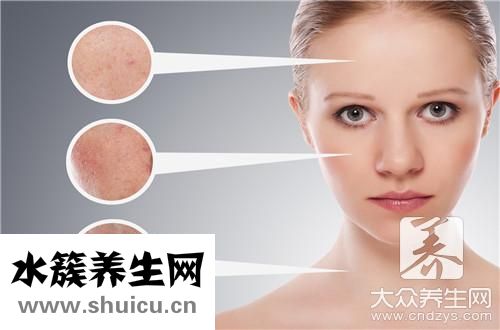 玫瑰痤瘡治療方法