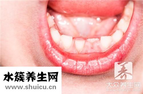 吃東西塞牙縫辦