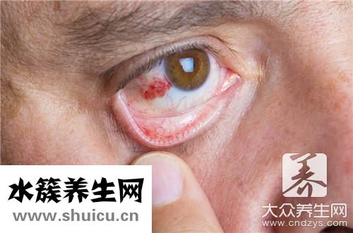 割雙眼皮有什么危害性